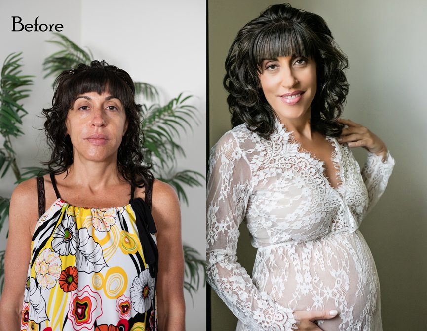 Pregnancy Photography - Before and After